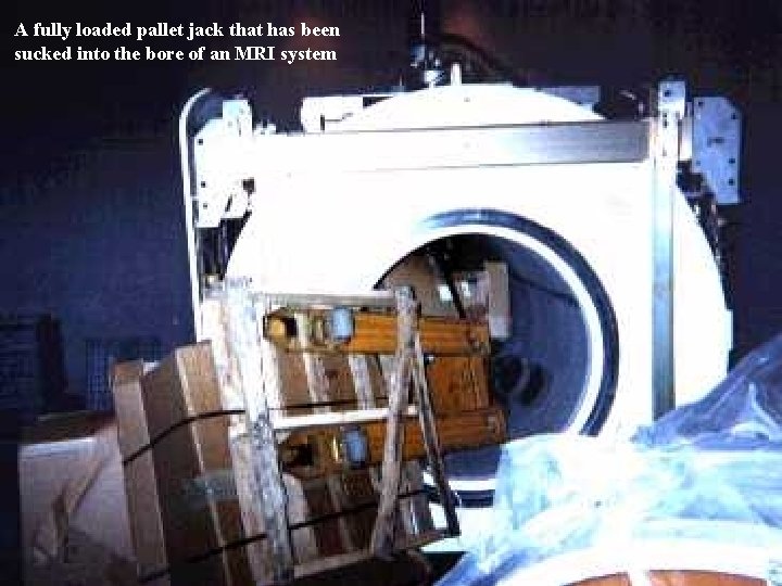 A fully loaded pallet jack that has been sucked into the bore of an