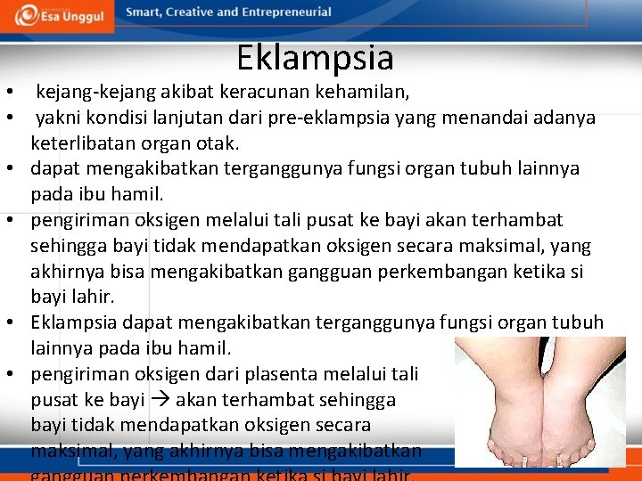 Eklampsia • kejang-kejang akibat keracunan kehamilan, • yakni kondisi lanjutan dari pre-eklampsia yang menandai