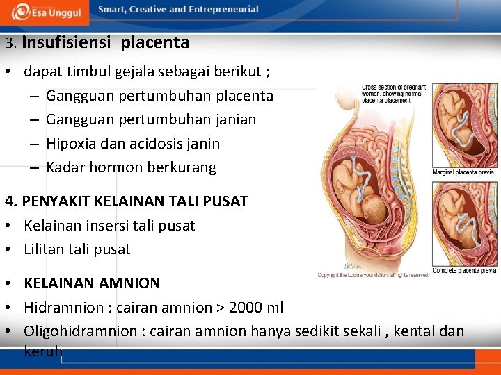 3. Insufisiensi placenta • dapat timbul gejala sebagai berikut ; – Gangguan pertumbuhan placenta