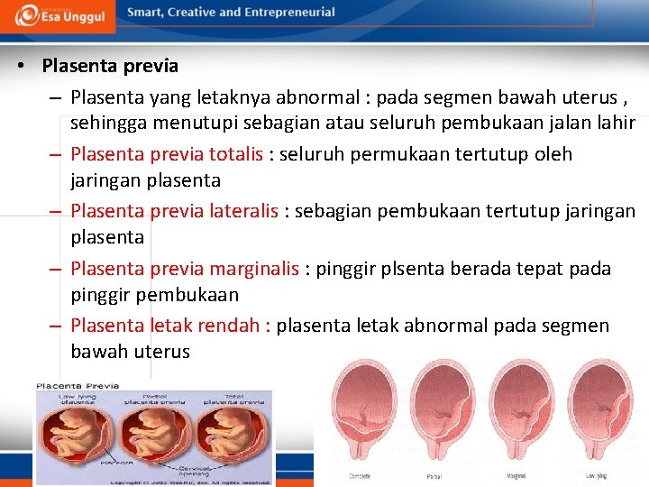  • Plasenta previa – Plasenta yang letaknya abnormal : pada segmen bawah uterus