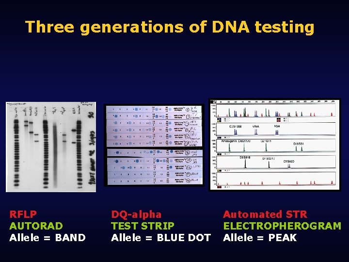 Three generations of DNA testing RFLP AUTORAD Allele = BAND DQ-alpha TEST STRIP Allele