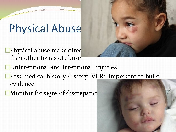 Physical Abuse �Physical abuse make direction much more objective than other forms of abuse