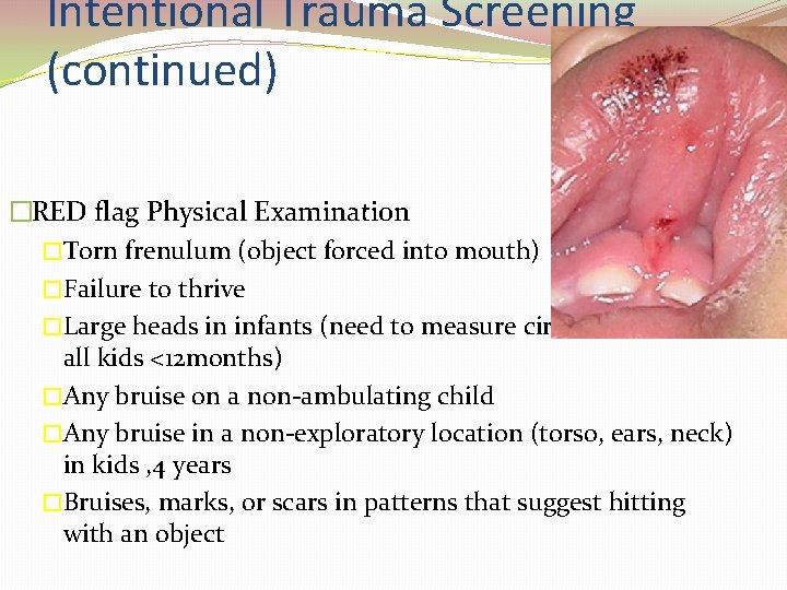 Intentional Trauma Screening (continued) �RED flag Physical Examination �Torn frenulum (object forced into mouth)