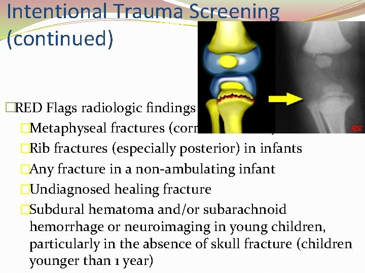 Intentional Trauma Screening (continued) �RED Flags radiologic findings �Metaphyseal fractures (corner fractures) �Rib fractures