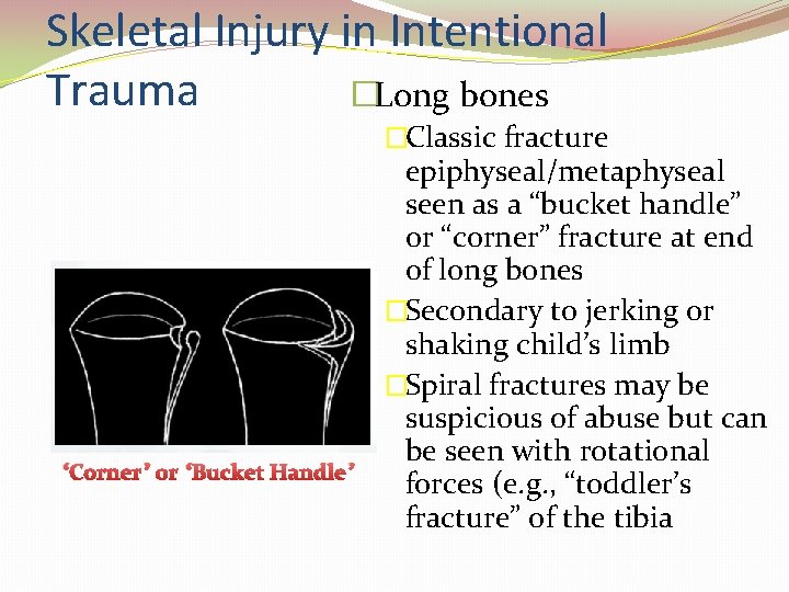 Skeletal Injury in Intentional Trauma �Long bones �Classic fracture “Corner” or “Bucket Handle” epiphyseal/metaphyseal