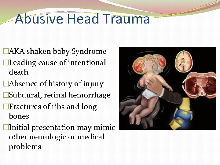 Abusive Head Trauma �AKA shaken baby Syndrome �Leading cause of intentional death �Absence of