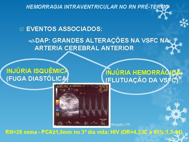 HEMORRAGIA INTRAVENTRICULAR NO RN PRÉ-TERMO þ EVENTOS ASSOCIADOS: DAP: GRANDES ALTERAÇÕES NA VSFC NA HEMORRAGIA INTRAVENTRICULAR NO RN PRÉ-TERMO þ EVENTOS ASSOCIADOS: DAP: GRANDES ALTERAÇÕES NA VSFC NA