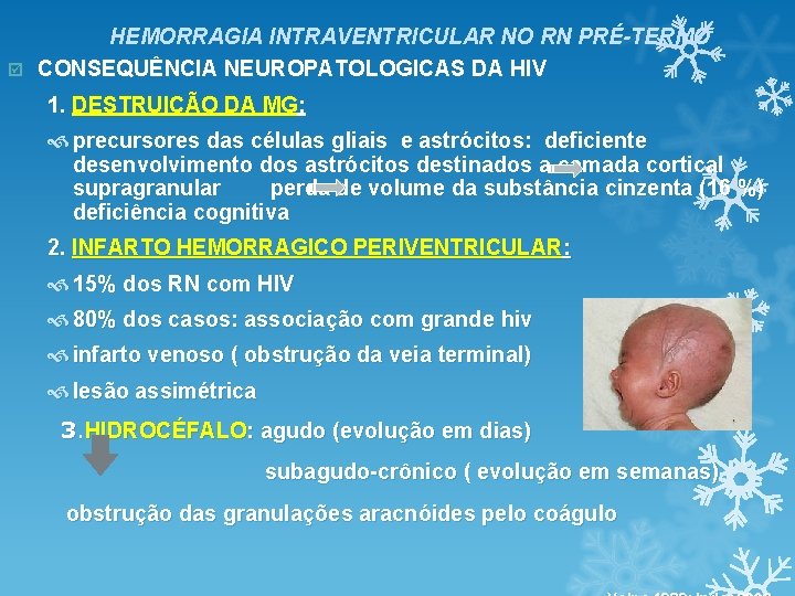 HEMORRAGIA INTRAVENTRICULAR NO RN PRÉ-TERMO þ CONSEQUÊNCIA NEUROPATOLOGICAS DA HIV 1. DESTRUIÇÃO DA MG: HEMORRAGIA INTRAVENTRICULAR NO RN PRÉ-TERMO þ CONSEQUÊNCIA NEUROPATOLOGICAS DA HIV 1. DESTRUIÇÃO DA MG: