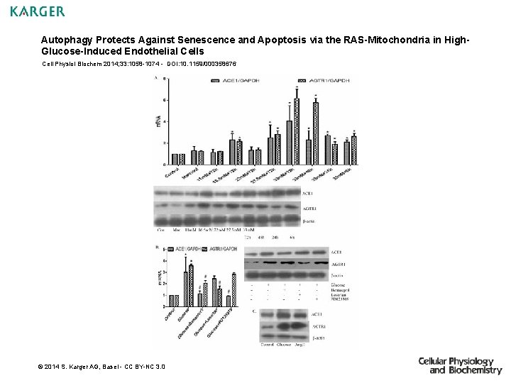 Autophagy Protects Against Senescence and Apoptosis via the RAS-Mitochondria in High. Glucose-Induced Endothelial Cells