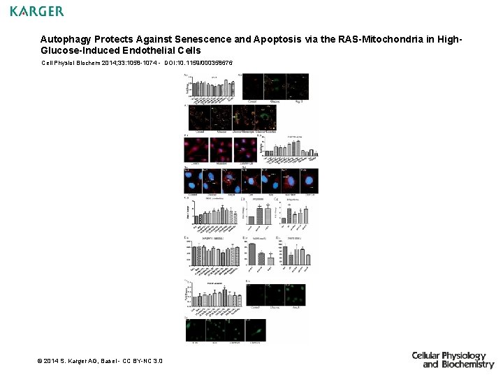 Autophagy Protects Against Senescence and Apoptosis via the RAS-Mitochondria in High. Glucose-Induced Endothelial Cells