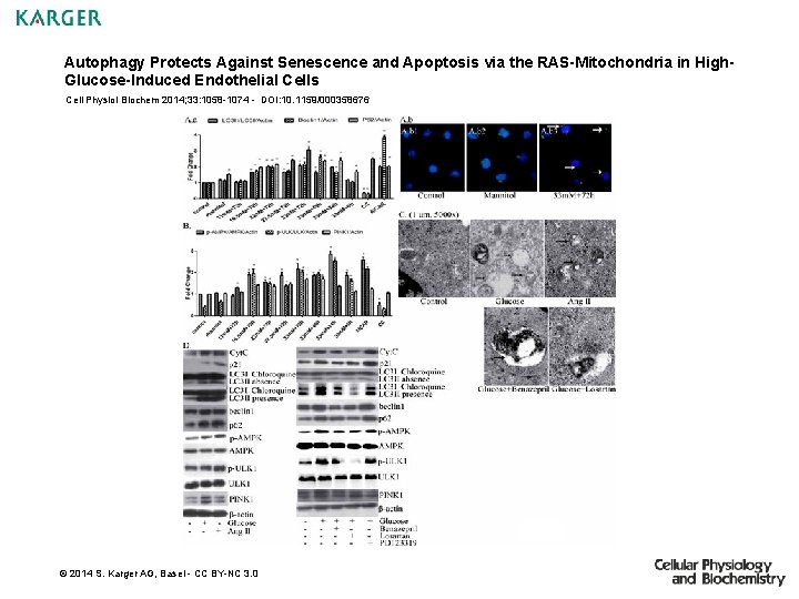 Autophagy Protects Against Senescence and Apoptosis via the RAS-Mitochondria in High. Glucose-Induced Endothelial Cells