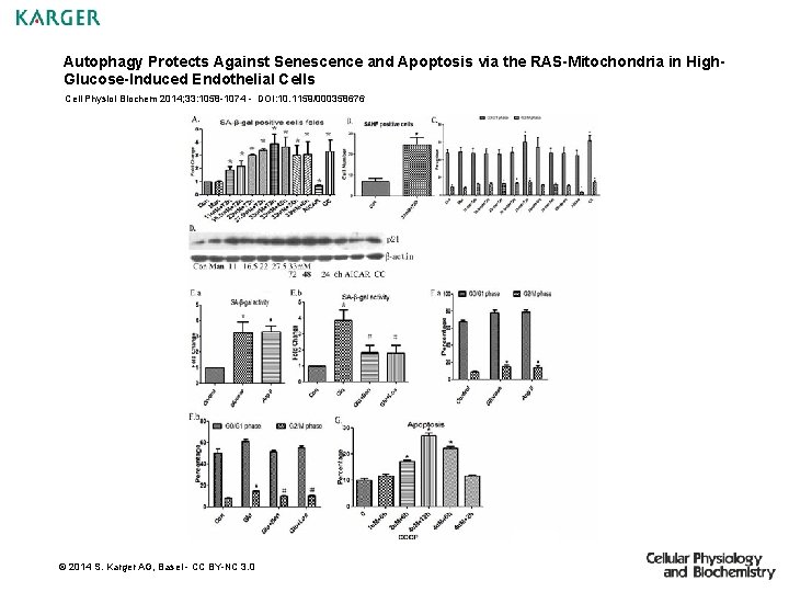 Autophagy Protects Against Senescence and Apoptosis via the RAS-Mitochondria in High. Glucose-Induced Endothelial Cells