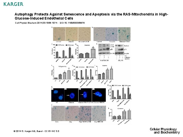 Autophagy Protects Against Senescence and Apoptosis via the RAS-Mitochondria in High. Glucose-Induced Endothelial Cells