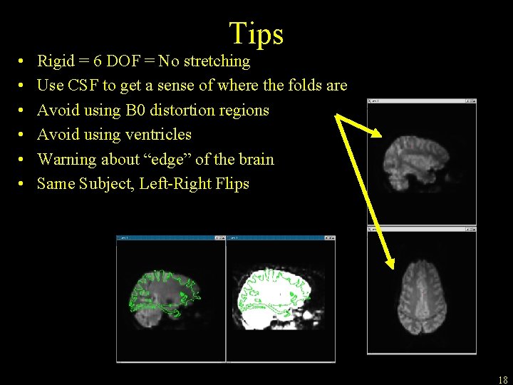 Tips • • • Rigid = 6 DOF = No stretching Use CSF to