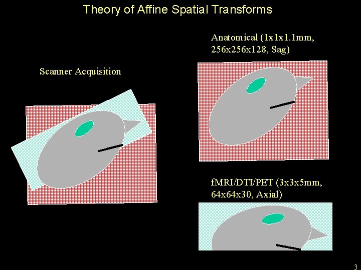 Theory of Affine Spatial Transforms Anatomical (1 x 1 x 1. 1 mm, 256