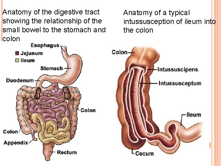 Anatomy of the digestive tract showing the relationship of the small bowel to the