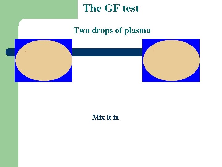 The GF test Two drops of plasma Mix it in 