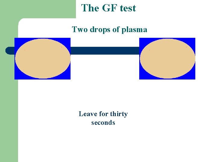 The GF test Two drops of plasma Leave for thirty seconds 
