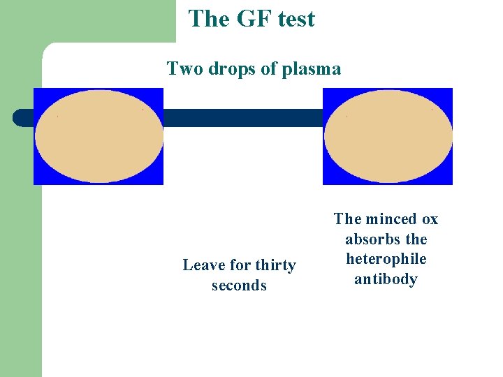 The GF test Two drops of plasma Leave for thirty seconds The minced ox