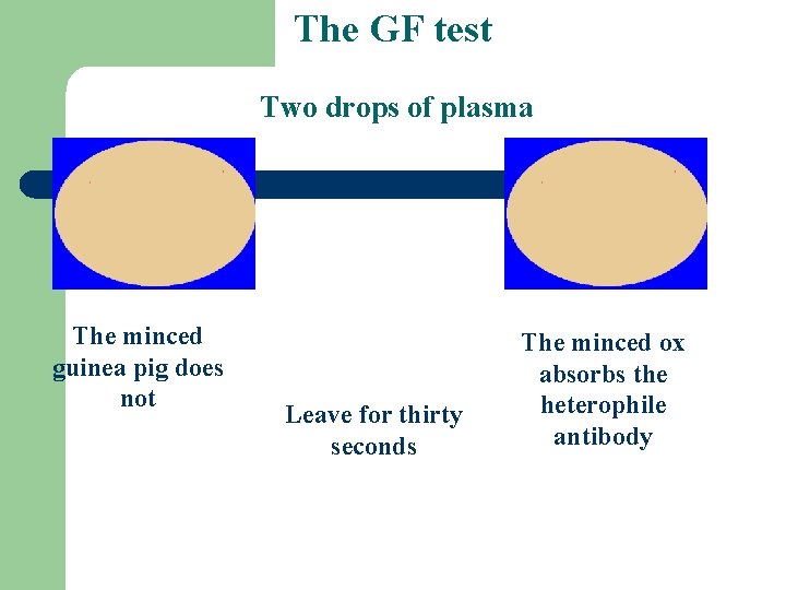 The GF test Two drops of plasma The minced guinea pig does not Leave