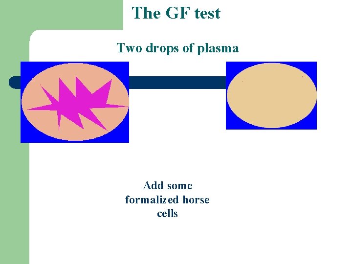 The GF test Two drops of plasma Add some formalized horse cells 