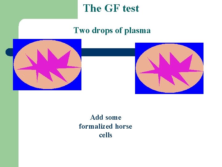 The GF test Two drops of plasma Add some formalized horse cells 