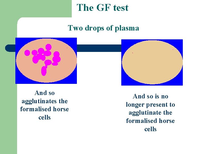 The GF test Two drops of plasma And so agglutinates the formalised horse cells