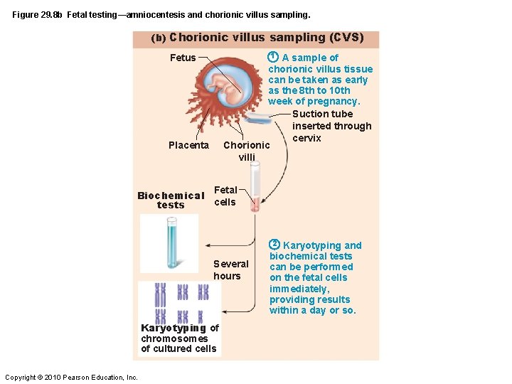 Figure 29. 8 b Fetal testing—amniocentesis and chorionic villus sampling. (b) Chorionic villus sampling