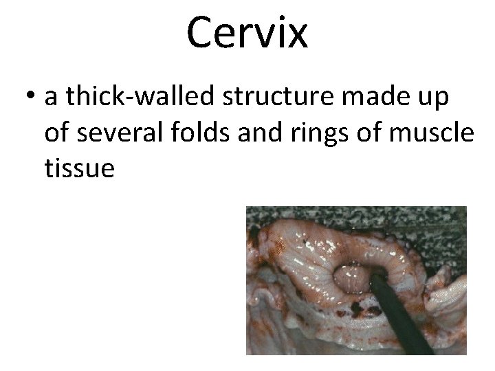 Cervix • a thick-walled structure made up of several folds and rings of muscle