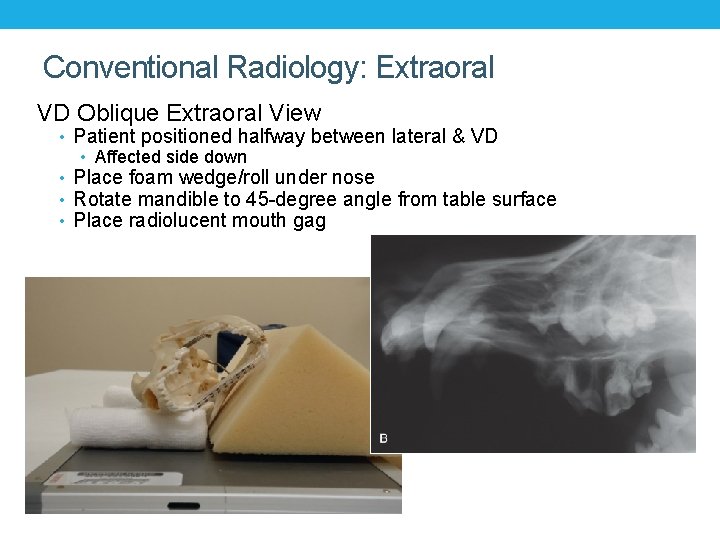 Conventional Radiology: Extraoral VD Oblique Extraoral View • Patient positioned halfway between lateral &