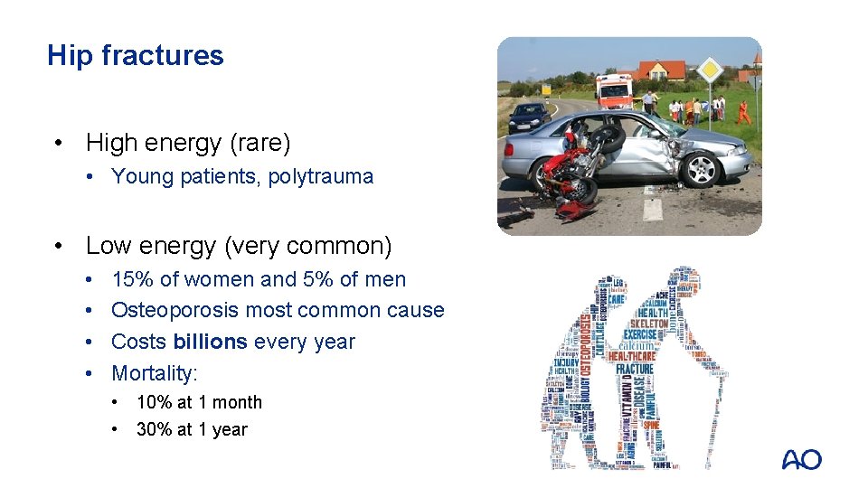 Hip fractures • High energy (rare) • Young patients, polytrauma • Low energy (very