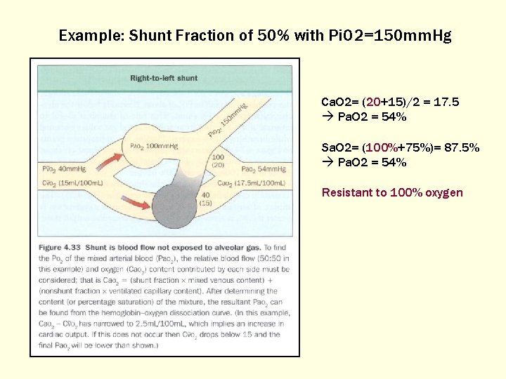Example: Shunt Fraction of 50% with Pi. O 2=150 mm. Hg Ca. O 2=