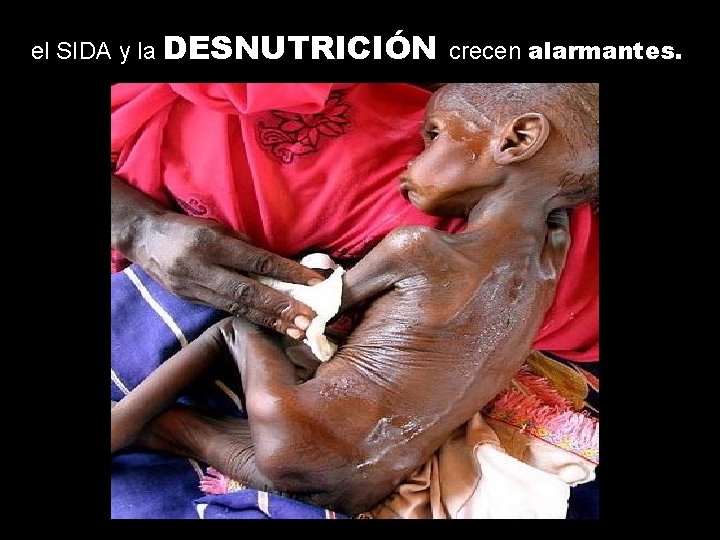 el SIDA y la DESNUTRICIÓN crecen alarmantes. 