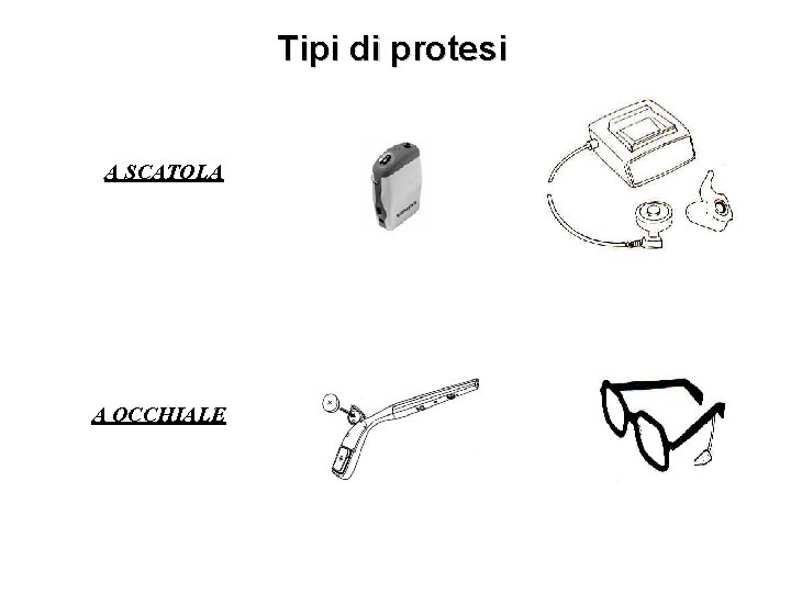 Tipi di protesi A SCATOLA A OCCHIALE 