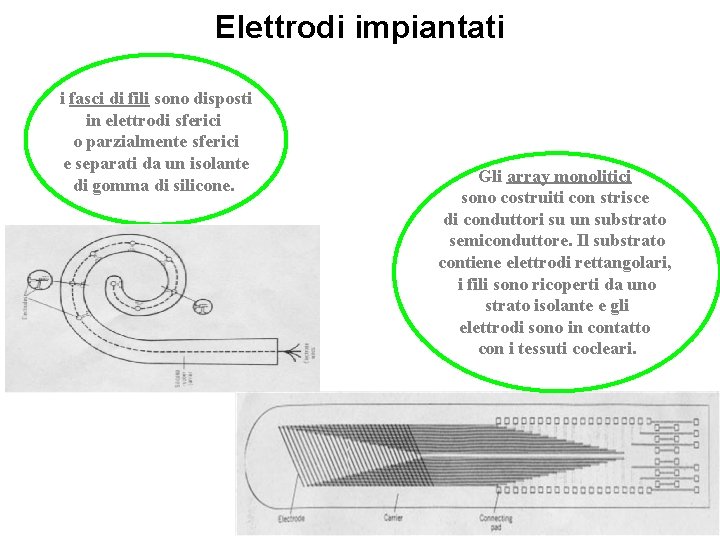 Elettrodi impiantati i fasci di fili sono disposti in elettrodi sferici o parzialmente sferici