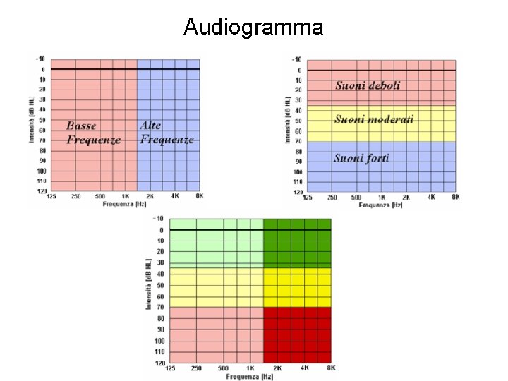 Audiogramma 