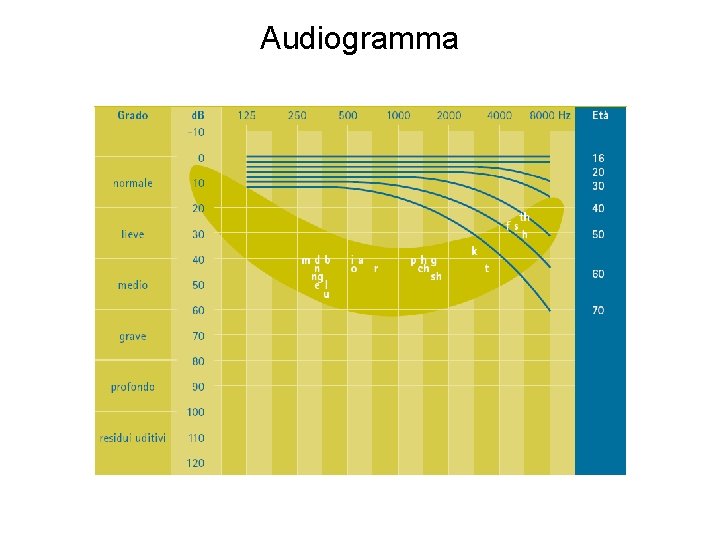 Audiogramma 