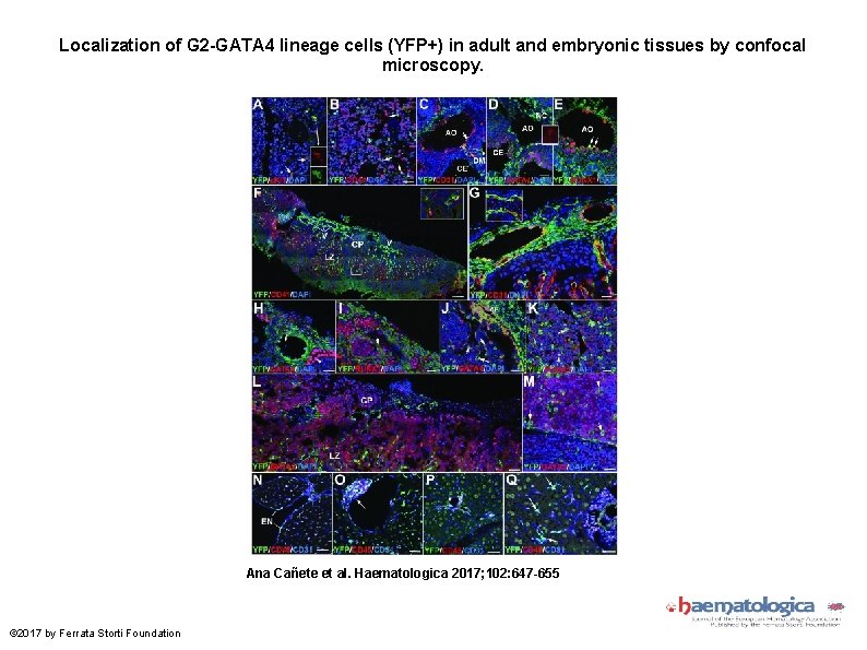 Localization of G 2 -GATA 4 lineage cells (YFP+) in adult and embryonic tissues