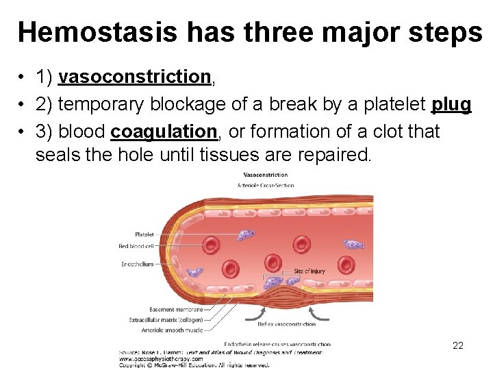 Hemostasis has three major steps • 1) vasoconstriction, • 2) temporary blockage of a