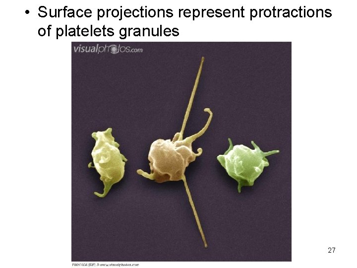  • Surface projections represent protractions of platelets granules 27 