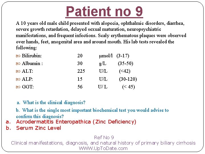 Patient no 9 A 10 years old male child presented with alopecia, ophthalmic disorders,