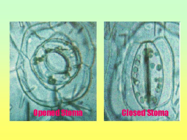Opened Stoma Closed Stoma 