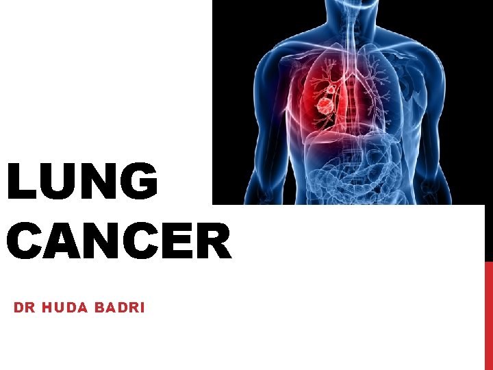 LUNG CANCER DR HUDA BADRI 