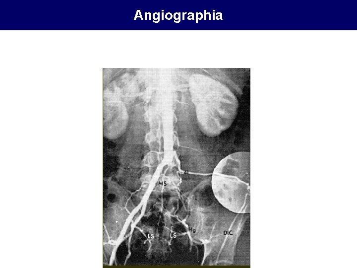 Angiographia 