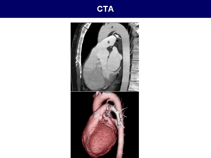 CTA 