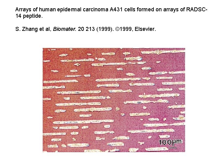 Arrays of human epidermal carcinoma A 431 cells formed on arrays of RADSC 14