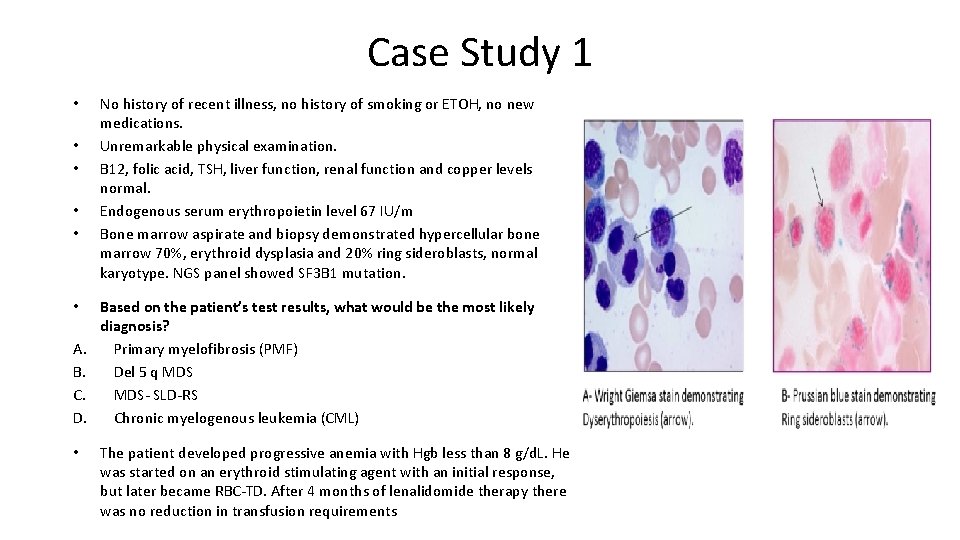 Case Study 1 • • • A. B. C. D. • No history of