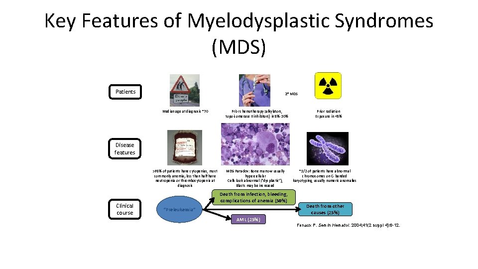Key Features of Myelodysplastic Syndromes (MDS) Patients 2 o MDS Median age at diagnosis
