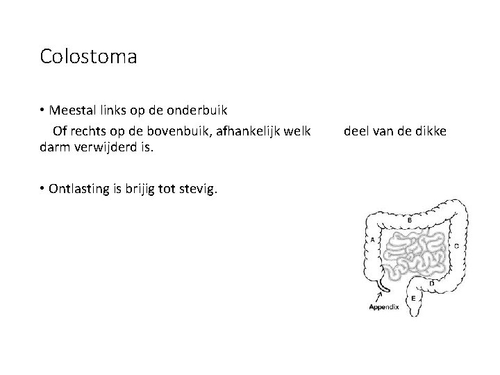 Colostoma • Meestal links op de onderbuik Of rechts op de bovenbuik, afhankelijk welk