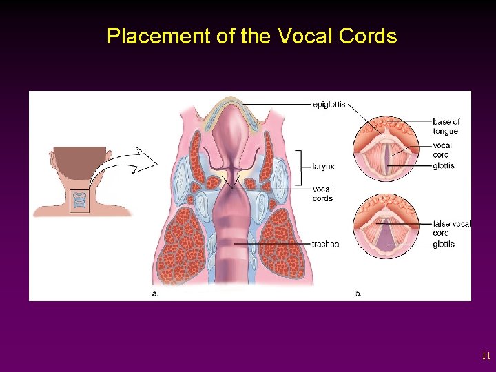 Placement of the Vocal Cords 11 